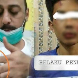 Pelaku Penusukan Syekh Ali Jaber Disebut Mirip Kelakuan PKI